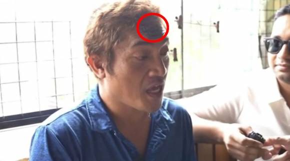 만우절 식당 주인의 장난에 속아 아들 학비를 마련하려고 이마에 식당 로고를 문신한 알바노 씨 / 사진=사우스차이나모닝포스트