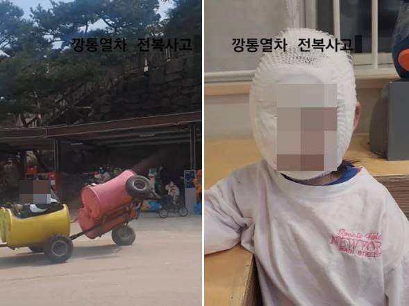 A씨가 공개한 사고 당시 모습과 부상 당한 쌍둥이의 얼굴 상태./온라인커뮤니티