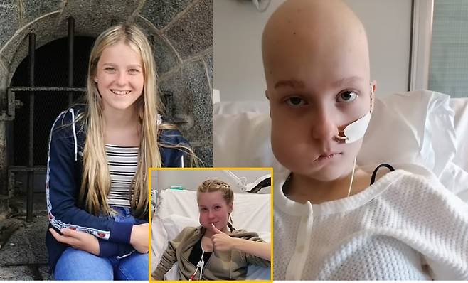 한 10대 소녀의 뺨에 생긴 완두콩 크기의 혹이 결국 암으로 판명돼 테니스공 크기까지 자란 사연이 전해졌다. 왼쪽-개비가 암 진단 받기 전의 긴 금발 머리였던 모습 / 오른쪽-항암치료를 받으면서 머리카락이 다 빠진 개비의 모습 [사진=영국 데일리메일 보도 캡처]