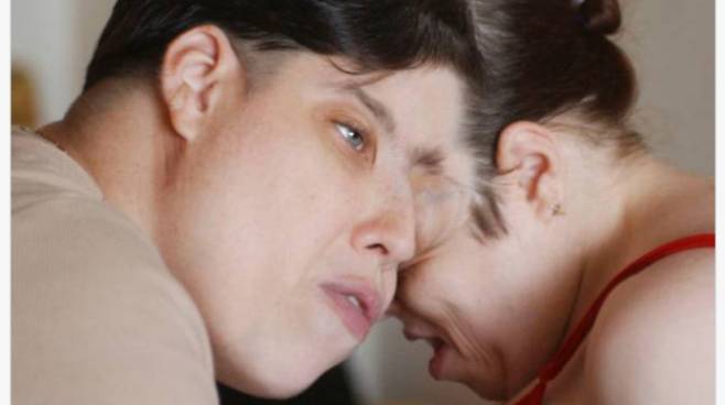 최고령 샴쌍둥이로 기네스북에 오른 조시 샤펠과 로리 샤펠이 지난 7일(이하 현지시각) 62세 나이로 별세했다. 사진은 최고령 샴쌍둥이로 기네스북에 오른 조지 샤펠과 로리 샤펠의 생전 모습. /사진=사회관계망서비스(SNS)캡처