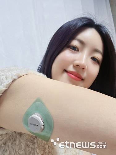 본지 송혜영 기자가 카카오헬스케어 파스타 앱과 연동된 G7 혈당패치를 부착한 모습.