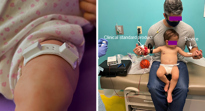 연구팀이 아기의 땀 성분 모니터링 기능을 확인하기 위해 왼쪽 팔에는 기존 유선 장비를, 오른쪽 팔에는 새로 개발한 장치를 붙여 실험하고 있다. KIST 제공