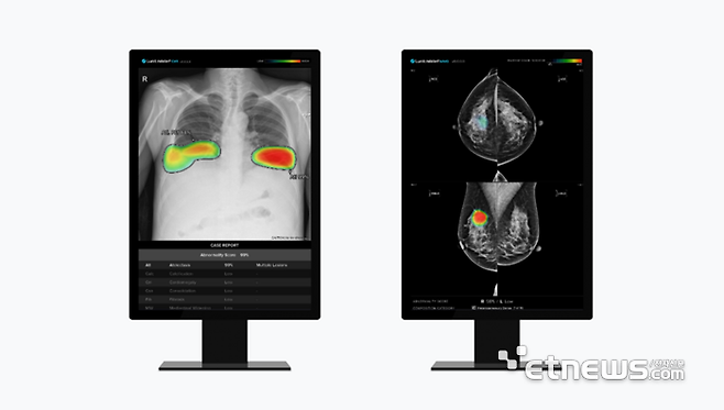 루닛 흉부 엑스레이 AI 영상분석 솔루션 '루닛 인사이트 CXR'(왼쪽) 및 유방촬영술 AI 영상분석 솔루션 '루닛 인사이트 MMG' (이미지 제공=루닛)