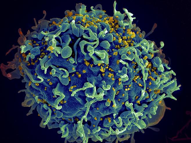 HIV에 공격받는 인간 T세포의 전자현미경 영상./AP연합뉴스