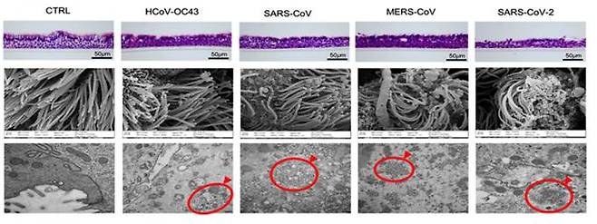 각 코로나바이러스 감염에 따른 세포의 변화, 감기 코로나바이러스(HCoV-OC43), 사스 코로나바이러스(SARS-CoV), 메르스 코로나바이러스(MERS-CoV), 코로나19 바이러스(SARS-CoV-2) 등 4종 바이러스 감염 후 세포 변화를 보여주는 현미경 이미지. IBS
