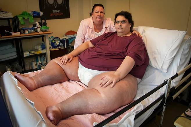 지난 5일(현지시각) 영국 일간 더선에 따르면 몸무게가 약 318kg에 달하던 제이슨 홀튼(33)이 이달 초 장기부전과 비만으로 사망했다./더선