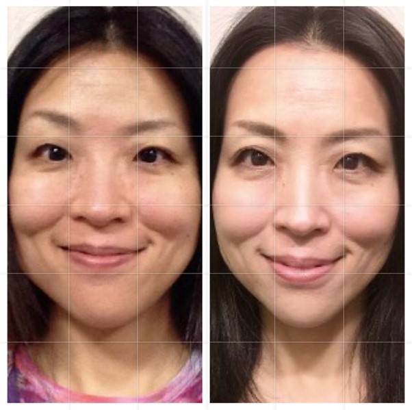 얼굴의 각도 차이로 비대칭이 개선된 듯한 느낌을 주는 사진. 눈과 눈썹의 높이를 보면 얼굴 각도가 자체가 다른 것을 알 수 있다.