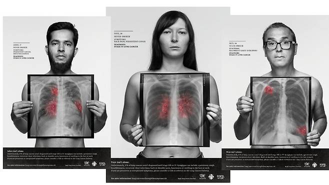 한 번도 담배를  피우지 않았지만 폐암 진단을 받은 영국 환자들이 자신의 폐 의료 영상을 들고 찍은 사진. 정부에 비흡연 폐암 환자에 대한 지원을 촉구하는 캠페인의 일환이다./Rankin