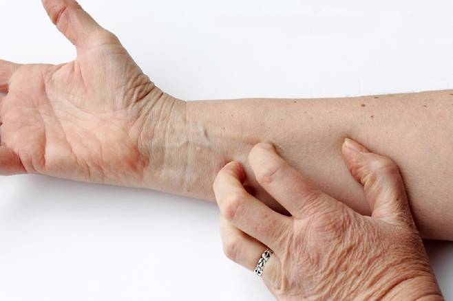 피부가 노화되면 피부 보호 물질인 천연보습인자 생성도 줄어 가려움증이 심해진다./사진=클립아트코리아