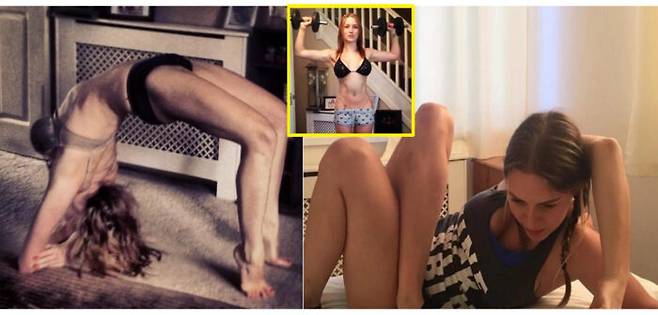 선천적인 콜라겐 결핍으로 관절이 지나치게 유연해 쉽게 탈골되고 멍이 드는 유전병 엘러스 단로스 증후군(EDS)을 앓는 여성 사연이 공개됐다. 어깨, 손목 등 다양한 곳의 관절이 쉽게 꺾이기 때문에 평소 유연하다고 생각하기 쉽지만 명확한 치료법이 없어 의심된다면 미리 검사받고 관리해야 한다. [사진=미국 일간 뉴욕포스트 캡처/SWNS 'tracykiss']