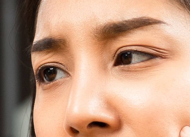 다크서클이 사라지지 않는다면 색소 침착 등 다른 이유 때문일 수 있다./사진=게티이미지뱅크