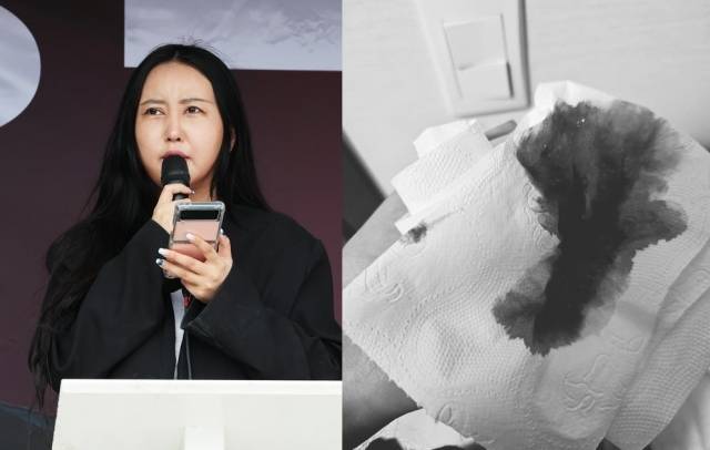 정유라씨와 그가 SNS에 올린 객혈로 추정되는 사진. 연합뉴스·페이스북
