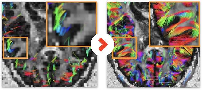 서울대가 도입하는 '고경사 확산 자기공명영상 시스템'(HG-dMRI)으로 촬영한 영상. (교육부 제공)