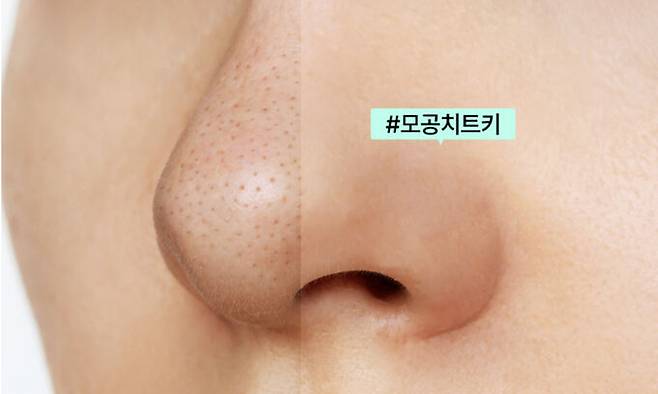 한 회사의 피지연화제 광고 사진 중 하나. 제품 사용 이해를 돕기 위해 포토샵으로 블랙헤드를 없앤 보정사진을 배치했다.&nbsp;제품 판매 페이지 캡처