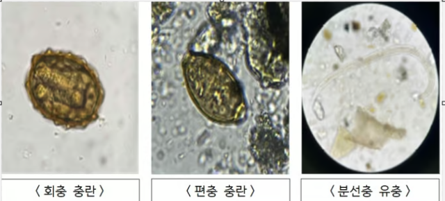 북한이 살포한 오물풍선 안에서 발견된 기생충들. 통일부는 기생충들이 인분으로부터 유래됐을 가능성을 보여준다고 밝혔다. 사진 제공=통일부