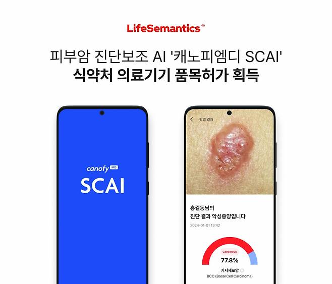 캐노피엠디 SCAI 화면. 라이프시맨틱스 제공