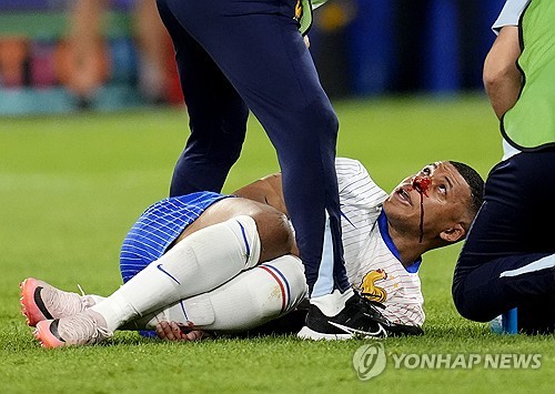 프랑스 축구대표팀을 이끄는 디디에 데샹 감독은 킬리안 음바페가 안면 보호용 마스크로 인해 경기를 치르는데 어려움을 겪고 있다고 밝혔다. 대한민국 축구대표팀 주장 손흥민도 과거 마스크를 쓰고 경기를 했기에 이에 대해 어려움을 토로한 적이 있다. 연합뉴스