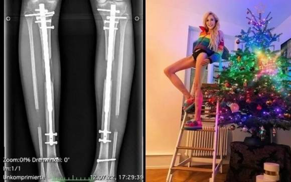 테레지아 피셔 인스타그램