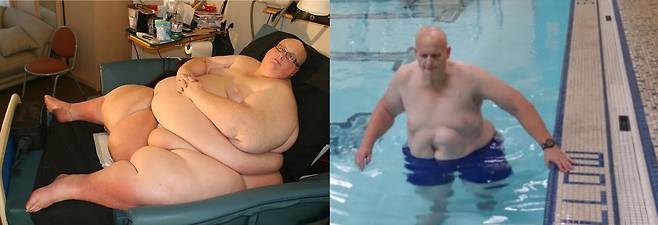 세계 최고 비만 기록을 세웠던 폴 메이슨(63)의 근황이 공개돼 화제가 되고 있다. 400kg 넘었던 모습과 현재 모습./사진=더 선