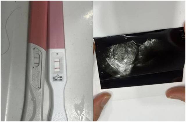 국가대표 출신 프로야구 선수의 아이를 임신했다가 낙태했다는 여성 A씨가 공개한 증거 사진. [온라인 커뮤니티]