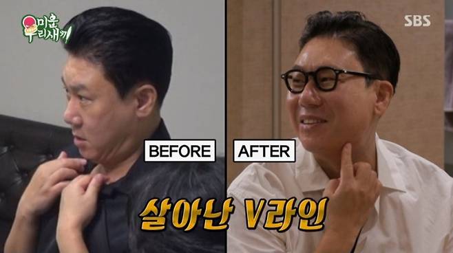 ‘미운우리새끼’ 이상민 성형 후기(사진: SBS)
