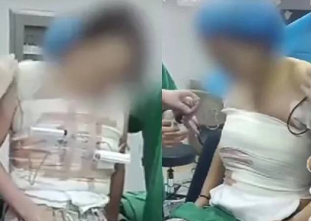 한 중국 여성의 가슴 확대 수술 영상이 온라인에 유출되면서 논란이 일고 있다.  [사진출처 = SCMP]