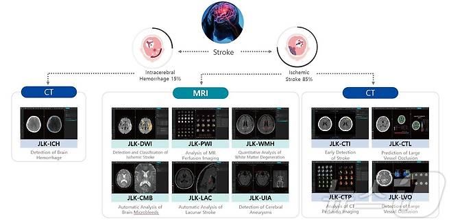 JLK Stroke Artificial Intelligence / 제이엘케이 뇌졸중전주기 풀 솔루션.(제이엘케이 제공)