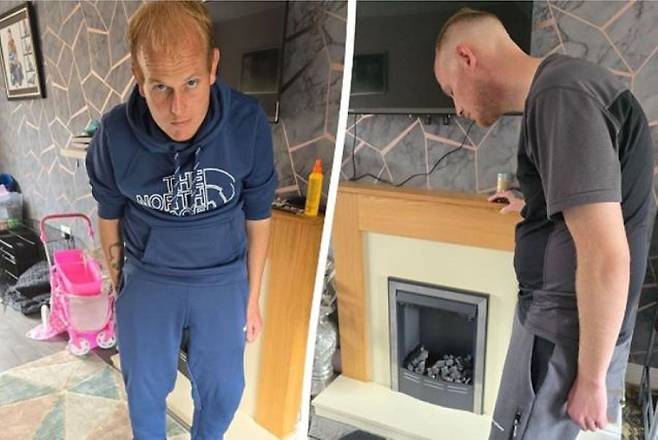 조나단 존슨(35)은 강직성척추염으로 목이 완전히 구부러졌다.​/사진=더 미러