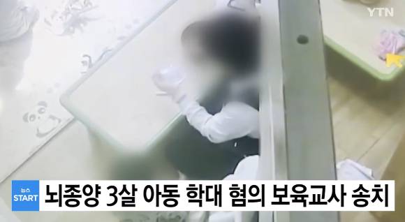 뇌종양을 앓고 있는 3세 남아를 수차례 때리고 밀쳐 학대한 혐의로 20대 여성 보육교사가 검찰에 송치됐다. 사진은 YTN 보도화면. [사진=YTN 방송화면]