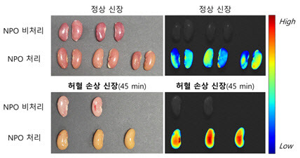 [이미지] 정상 쥐의 신장(위)과 허혈 손상 쥐의 신장(아래). 형광 분자 프로브(NPO) 처리 후 허혈 손상 신장에서 형광 강도가 높아진 것을 확인할 수 있음.