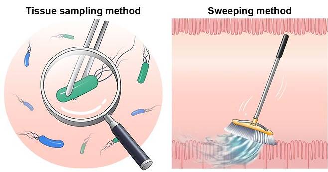[수원=뉴시스] 기존 조직 채취 검사(왼쪽)과 새로운 방식의 스위핑 방법(오른쪽). (사진=아주대의료원 제공) 2024.08.07. photo@newsis.com *재판매 및 DB 금지