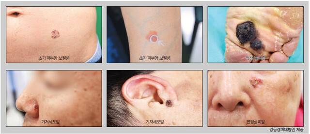 <font color=green>이미지를 크게 보려면 국민일보 홈페이지에서 여기를 클릭하세요</font>