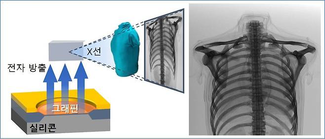 세종대와 LG전자 공동 연구진이 개발한 그래핀 기반 반도체 X선 장비의 작동 모식도(왼쪽). 연구진은 인체를 모사하는 팬텀 내부의 갈비뼈 구조를 촬영하는 데 성공했다. 반도체 기반 X선 장비로 의료용 영상을 촬영한 것은 세계 최초다./세종대