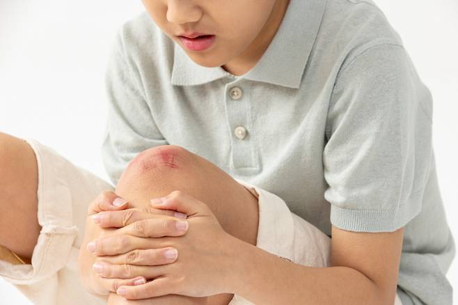 상처 종류에 따른 마데카솔 활용법이 주목된다. 사진은 기사 내용과는 무관함. /사진=이미지투데이