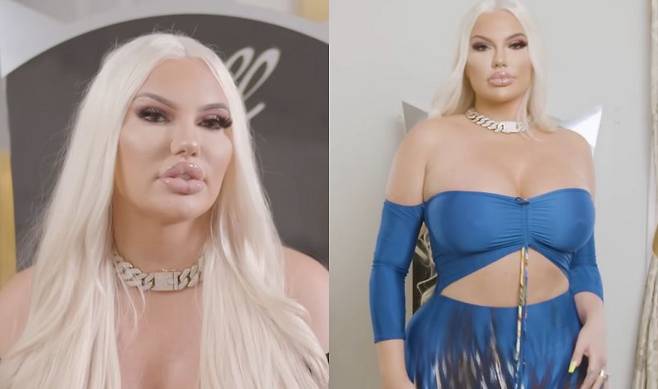 스테이시 돌은 18살에 불법 엉덩이 시술을 받으면서 성형수술을 받기 시작했다.​/사진=유튜브 채널 ‘truly’​