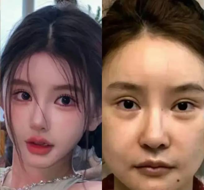 뷰티 인플루언서 왕징(왼쪽)과 왕징을 따라 성형한 여성./중국 지식검색 웹사이트 즈후