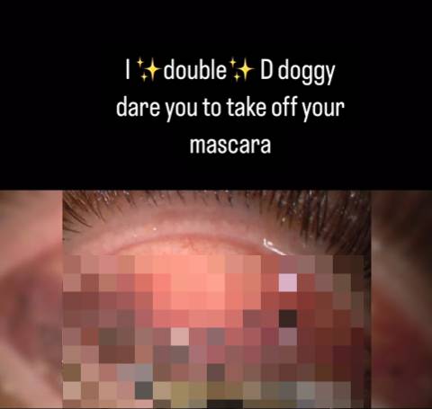 워터프루프 마스카라를 지우지 않고 그대로 자면 심각한 부작용이 생길 수 있다는 경고가 나왔다./사진=구르린 다노아 박사 인스타그램 캡처