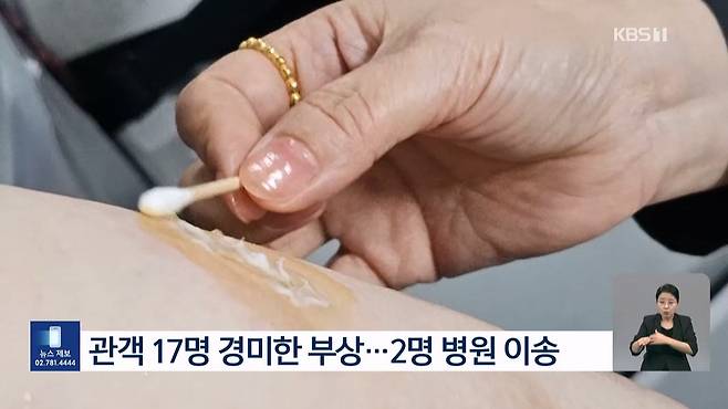 제천국제음악영화제 행사장서 폭죽 사고…관객 17명 다쳐 2명 병원 이송