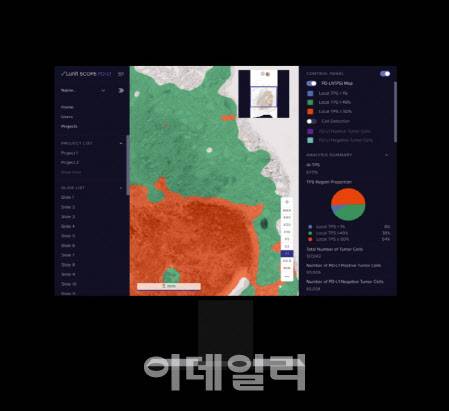 루닛 스코프 제품 분석 모습 (사진=루닛)