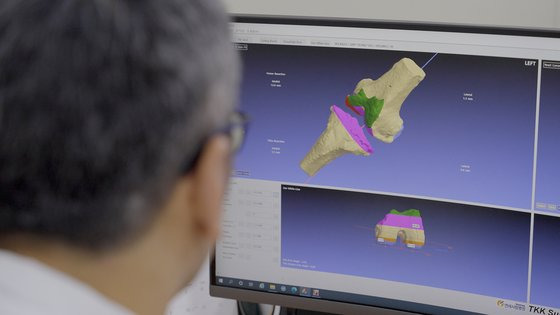 연세사랑병원 연구진이 MRI 무릎 관절 영상을 분석하고 있다. 사진 연세사랑병원