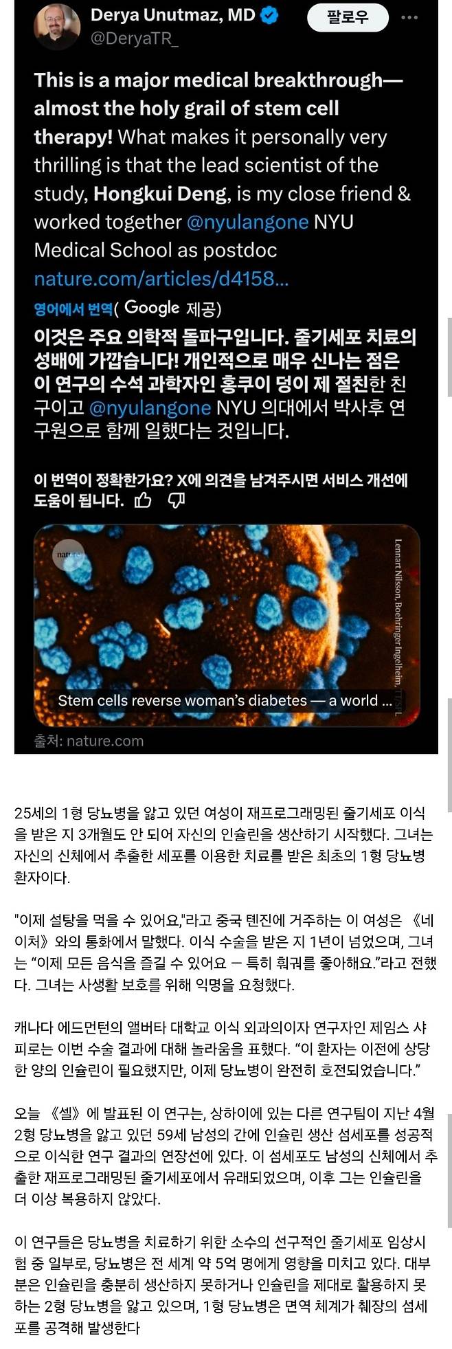 세계 최초 줄기세포 이식으로 1형 당뇨병 완치 성공.