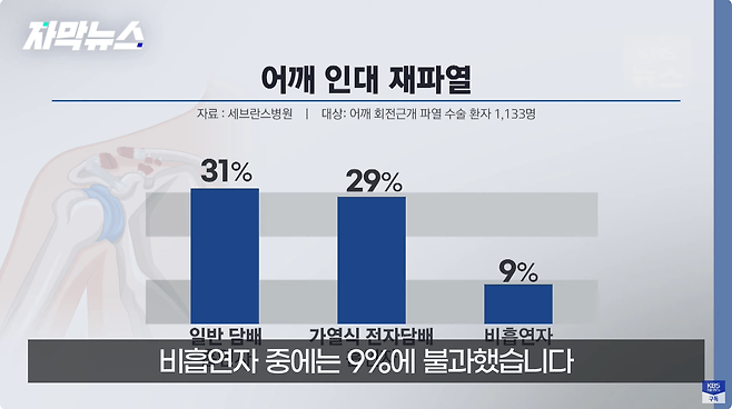 6.png \'어깨 인대 파열\' 수술하고 담배 계속 피웠더니 생긴 일