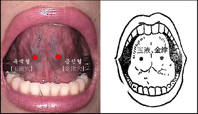 혀 아래에는 설하정맥이 있는데, 왼쪽 설하정맥 중간 부위를 금진혈(金津穴), 오른쪽 부위를 옥액혈(玉液穴)이라고 한다. 옛날부터 이 부위를 출혈시켜서 어혈을 제거하는 치료에 활용하였다.