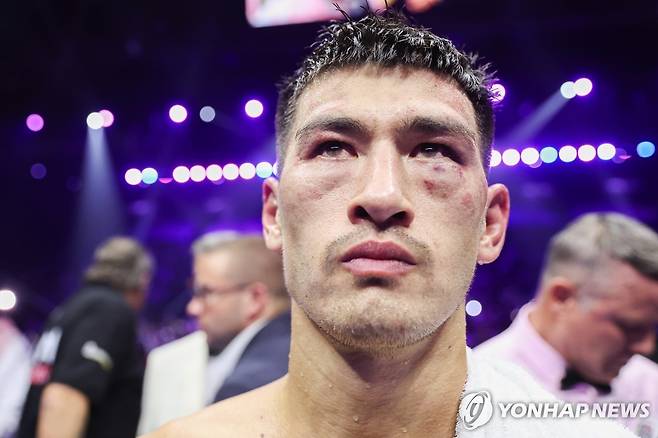 패배에 아쉬워하는 비볼 [TASS=연합뉴스]