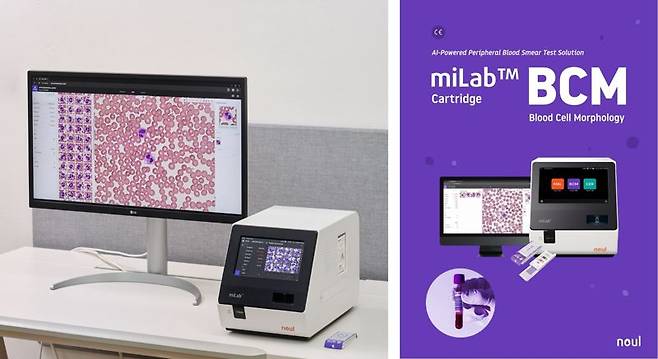 인공지능(AI)로 비정상적 혈액 세포를 구별하는 노을의 혈액 분석 솔루션 'miLab BCM'. 노을 제공