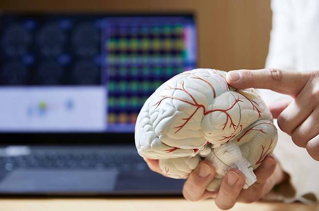 뇌전증 발작은 이상 뇌파가 발생하는 영역에 따라 그 유형도 다르다./사진=신지호 기자