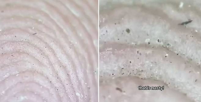 미국의 한 의사가 현미경으로 손을 관찰한 영상을 게재했다. 사진은 깨끗해 보이던 손가락 한 마디를 현미경으로 관찰했을 때 보인 세균의 모습이다./사진=피로 피구라 틱톡 캡처