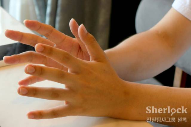 ▲ 약물 부작용으로 생긴 수전증은 일상에 지장을 줄 만큼 심해졌다. ⓒ셜록