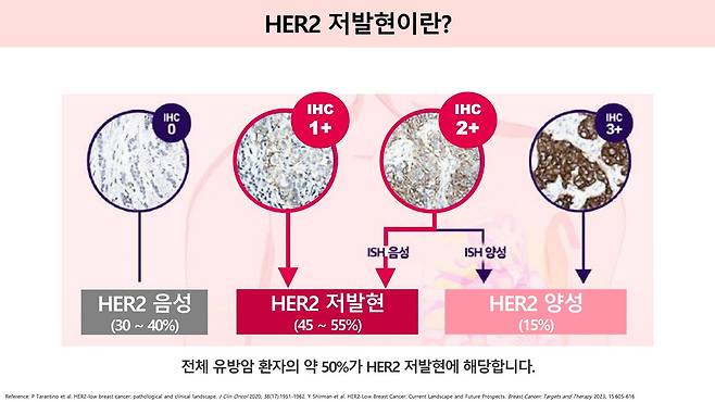 HER2 저발현 환자는 전체 유방암 환자의 약 45~55%를 차지한다./사진=헬스조선DB
