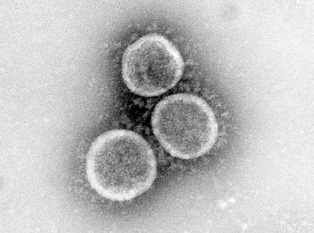 코로나19 바이러스. (사진=미국 국립알레르기전염병연구소)